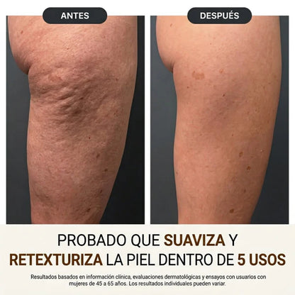 NovaPure Oil® Aceite corporal de seda  Redescubre la confianza con una piel más firme, suave y radiante