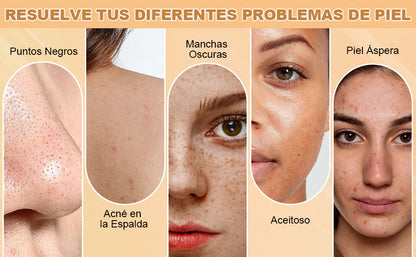 2x Pack Jabon de ácido Kojico Skincare®
