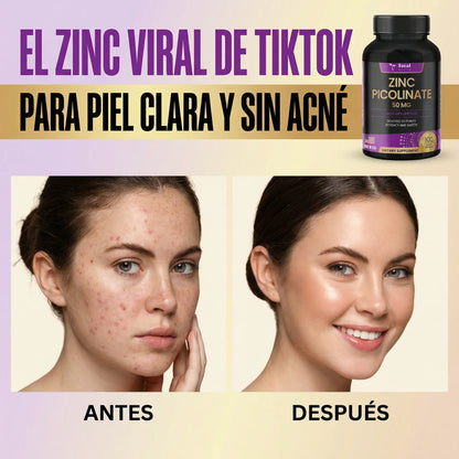 Zinc Picolinate – Defensas, piel y hormonas sanas. 60 CAPSULAS EL ZINC QUE SÍ SE ABSORBE/ SOLO POR ESTE MES 2X1